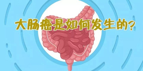 大肠*有哪些蛛丝马迹？