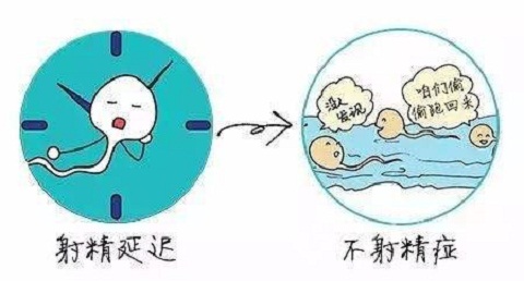 为什么会有不射精症？